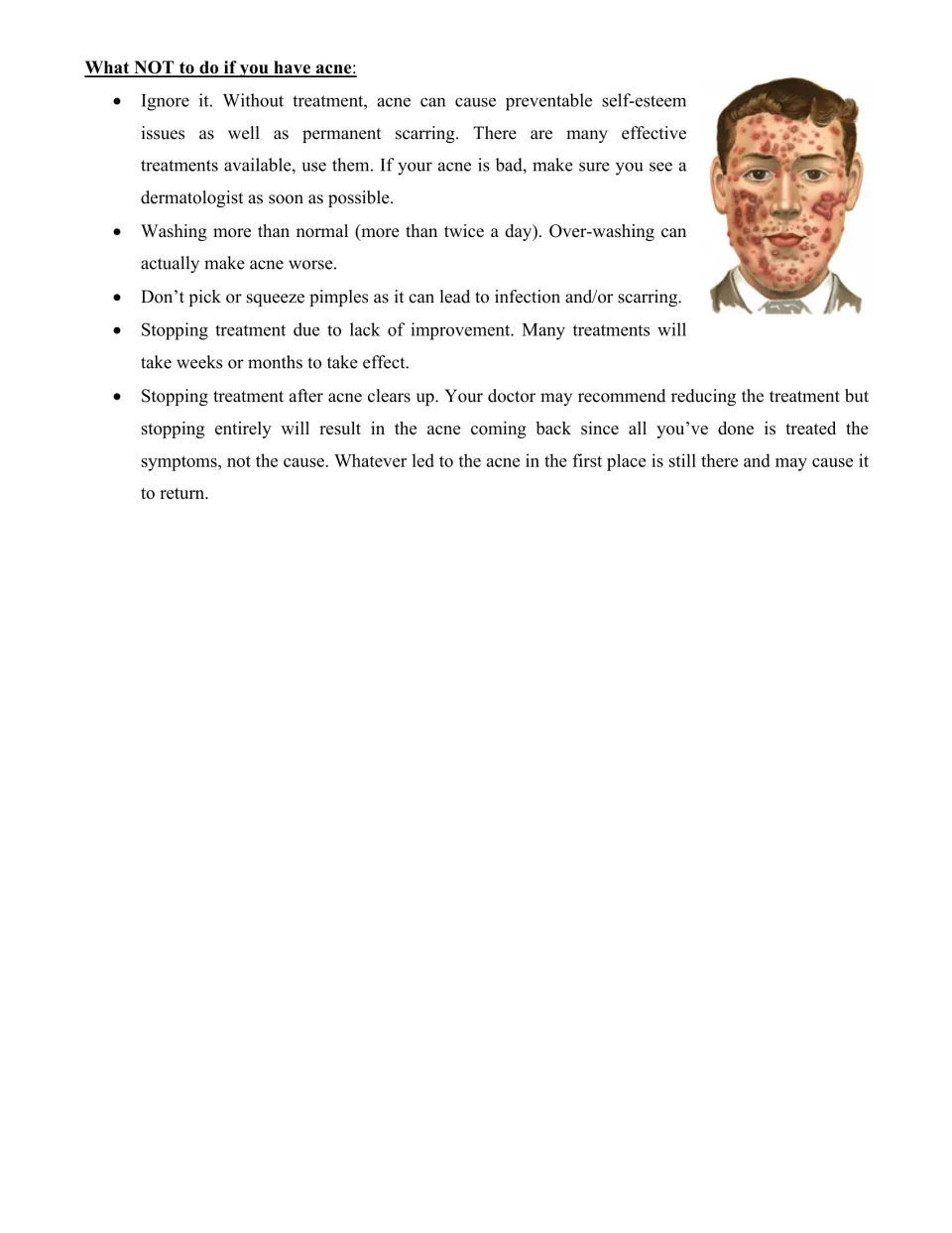What not to do if you have acne: students read why picking, over-washing or stopping treatment early can make it worse