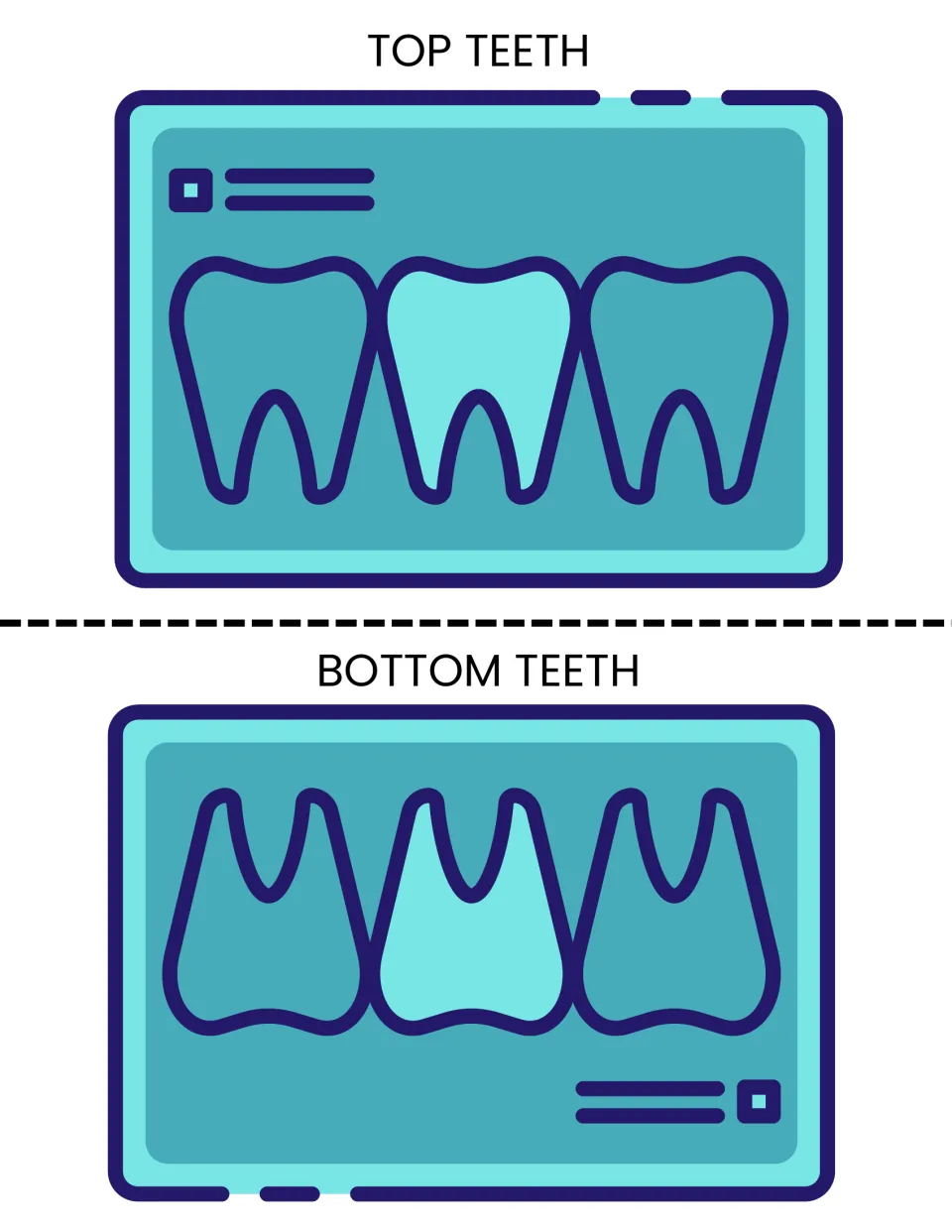 Top teeth and bottom teeth cards styled as dental x-ray screens, each picturing three teeth for the pretend dentist