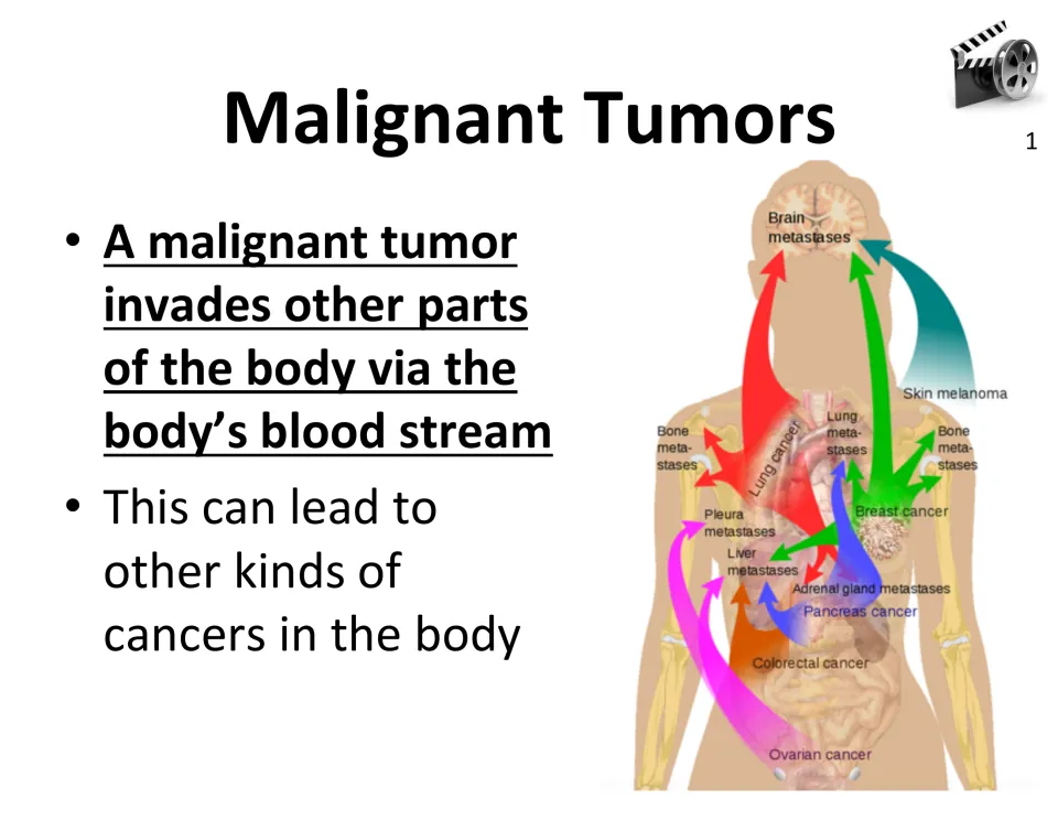 Malignant tumor spread slide describes movement through the bloodstream, with a metastasis diagram and video 1