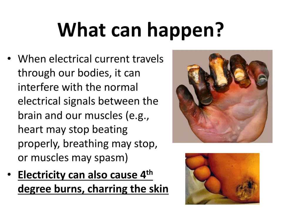 Hazards slide explains disrupted heart, breathing, and muscle signals, with photos of severe electrical burns