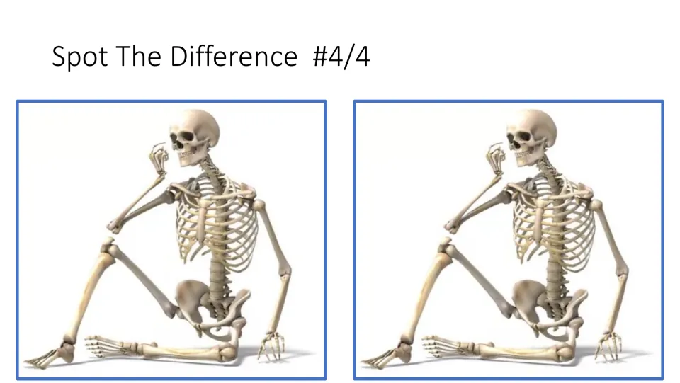 Spot-the-difference task 4 of 4 in the lesson starter asks students to compare two seated human skeletons
