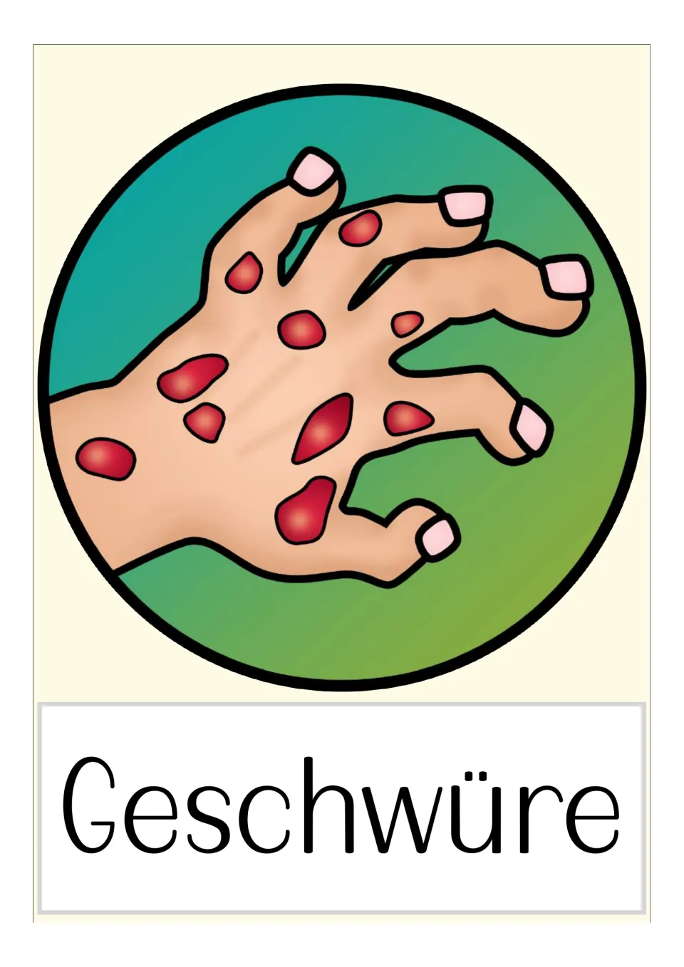 German plague flashcard labeled 'Geschwüre' (boils), illustrated with red sores covering a hand and wrist