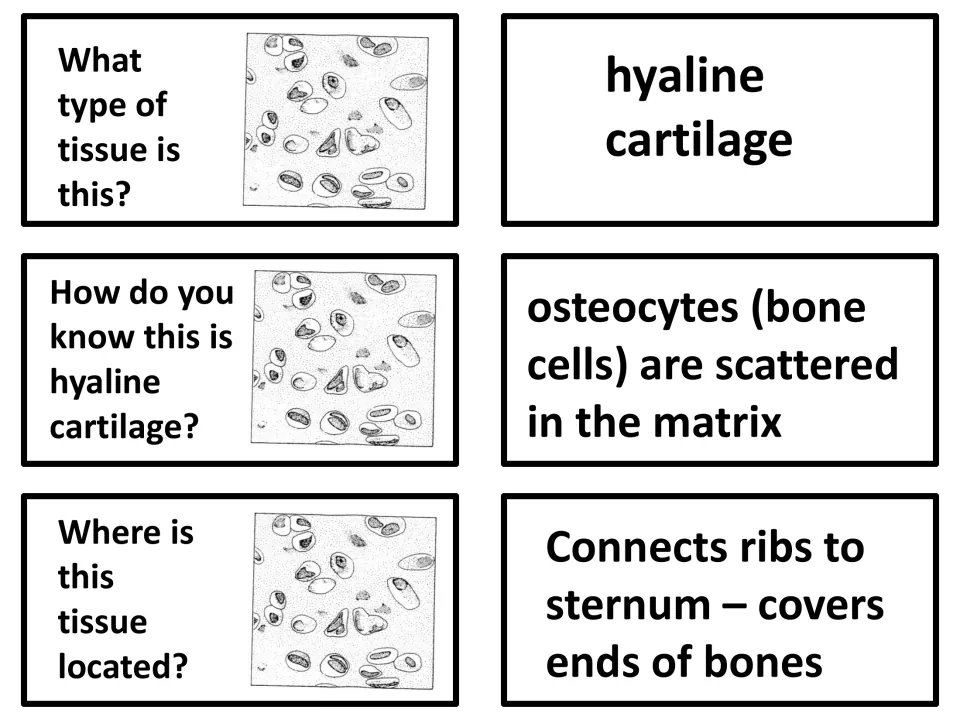 Hyaline cartilage cards: identify a micrograph drawing, explain scattered cells in the matrix, locate it at ribs and sternum