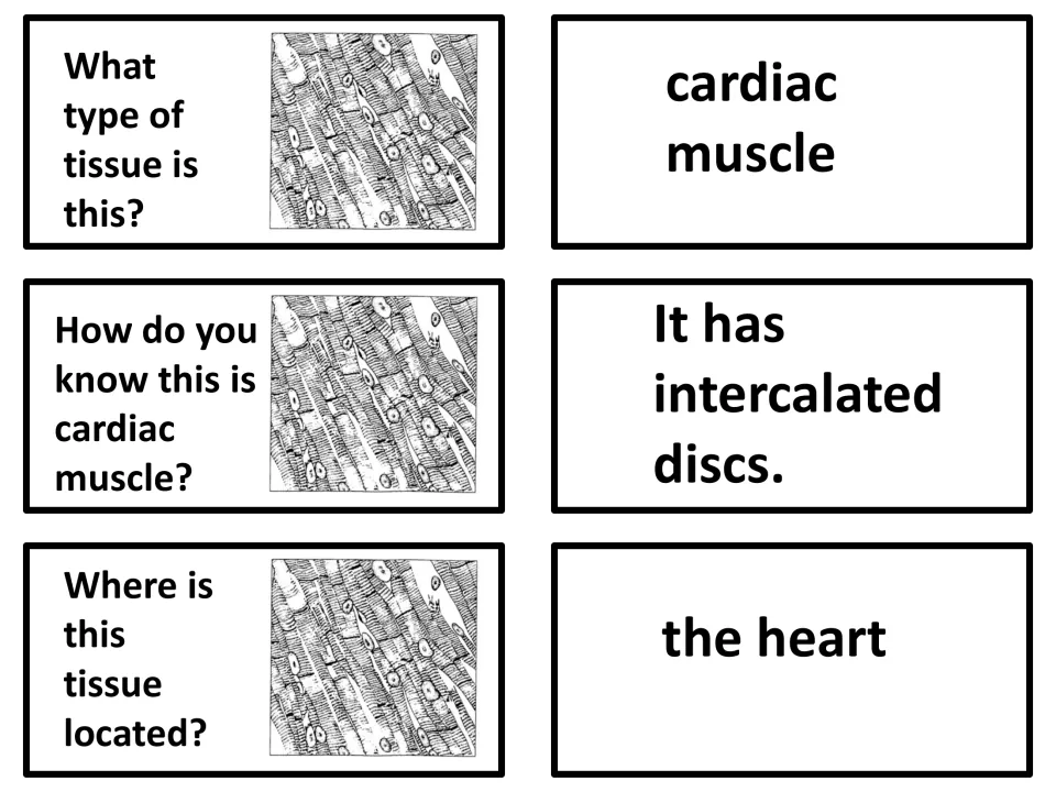 Cardiac muscle: three question-and-answer cards on identifying the tissue, its intercalated discs and its place in the heart