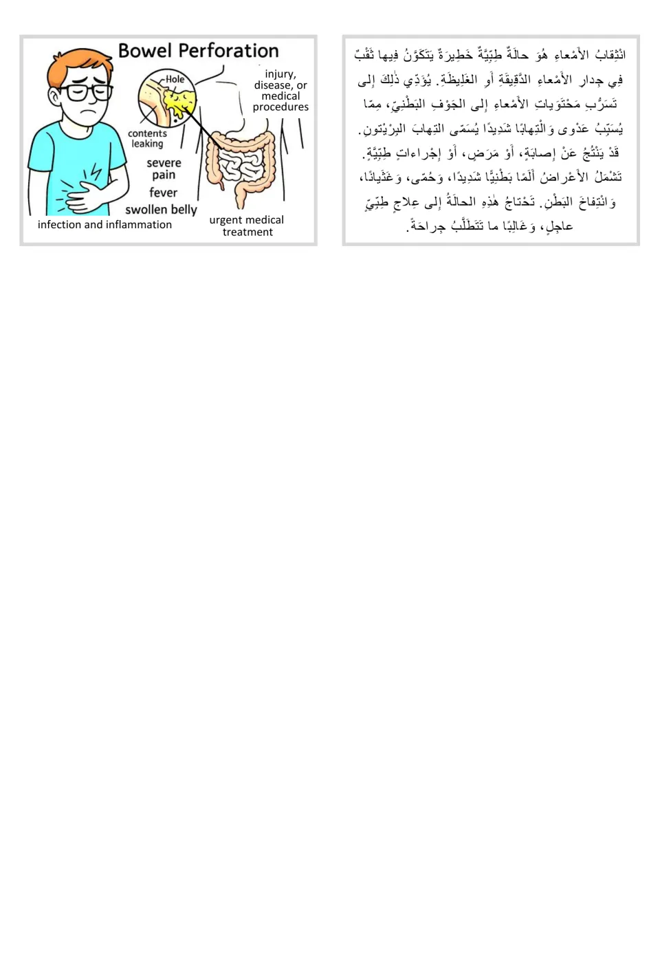 Bowel perforation flashcard showing a hole and leaking intestinal contents, paired with Arabic information