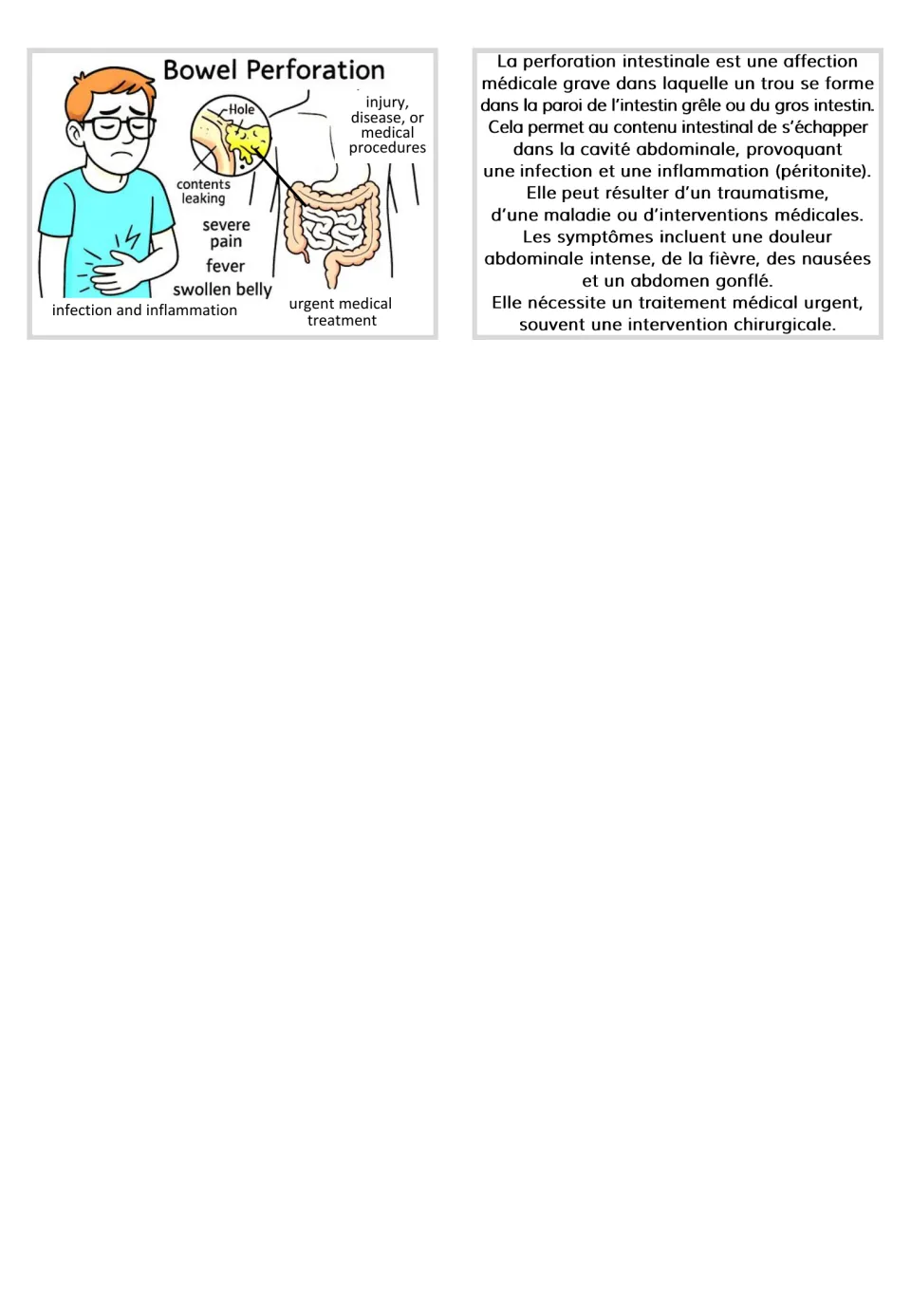 Bowel perforation card pair combines a labeled intestinal hole illustration with a French informational text