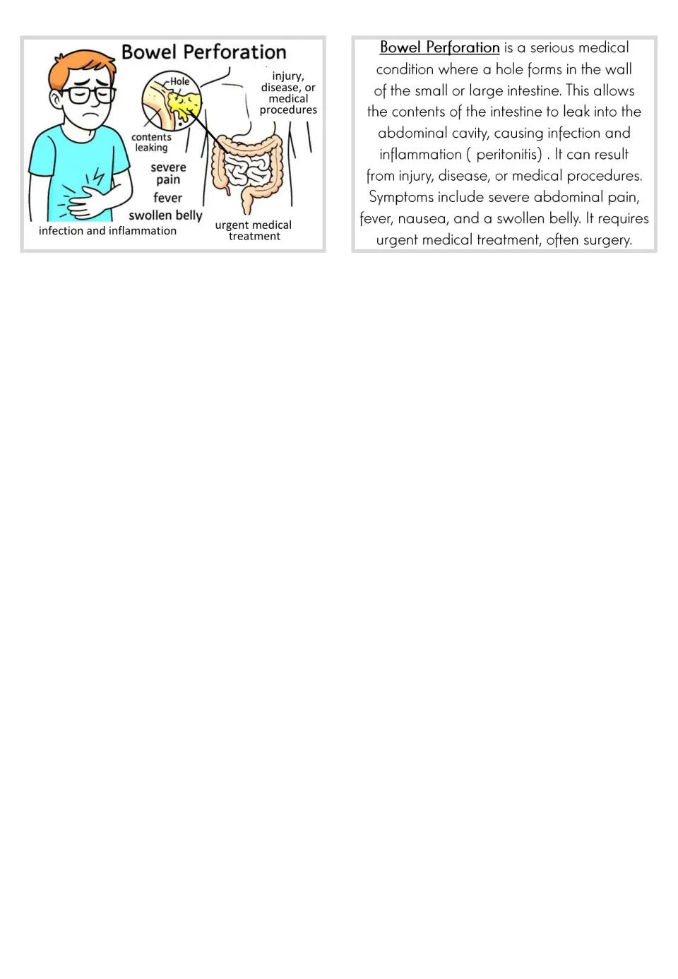 Bowel perforation flashcard and matching text explain an intestinal hole, symptoms, and urgent treatment