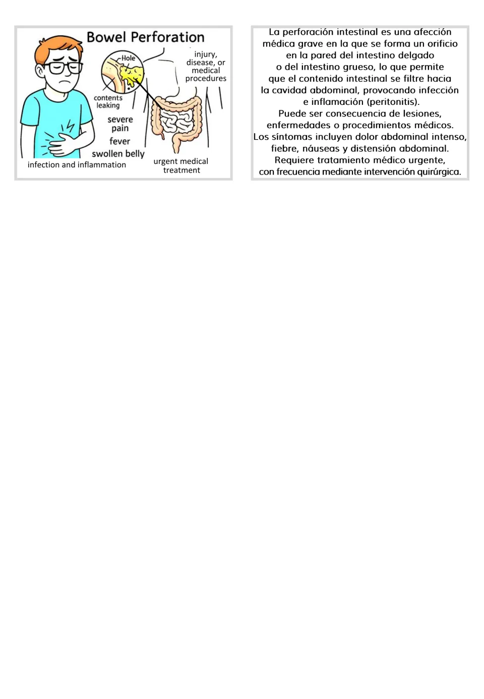 Bowel perforation flashcard showing an intestinal hole and symptoms, paired with Spanish informational text