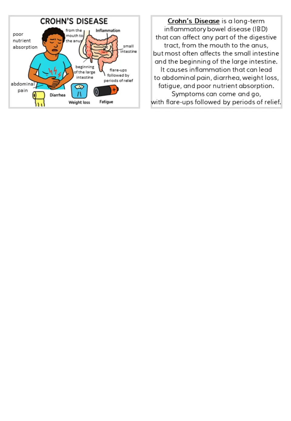 Crohn’s disease flashcard pair: digestive tract illustration, symptom labels, and matching information