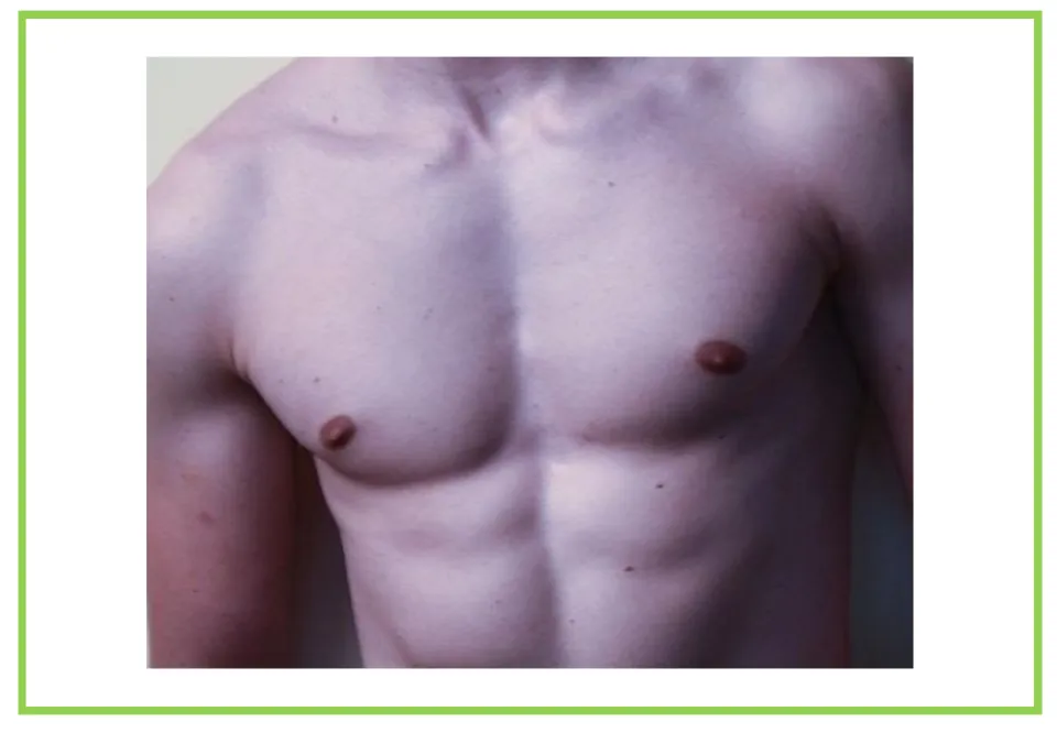 Picture-only body vocabulary flashcard showing a bare chest and abdomen, paired with the labeled chest card