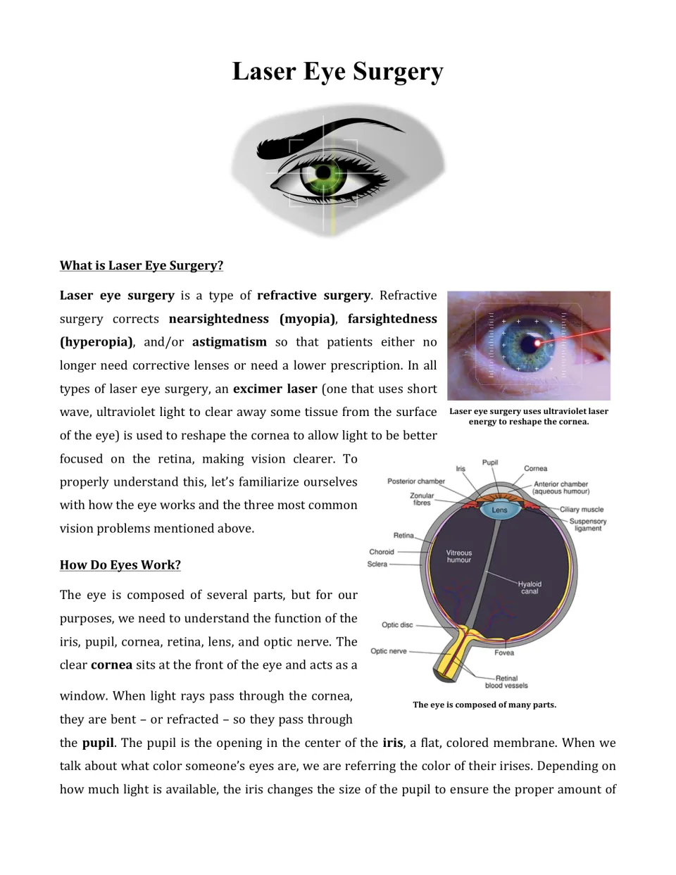 Article opening explains refractive surgery and how eyes work, with a labeled diagram of eye anatomy.