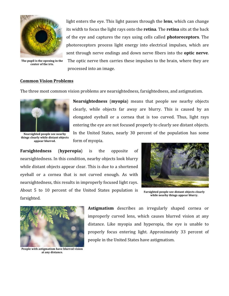 Article continuation explains the retina and optic nerve, then myopia, hyperopia, and astigmatism.