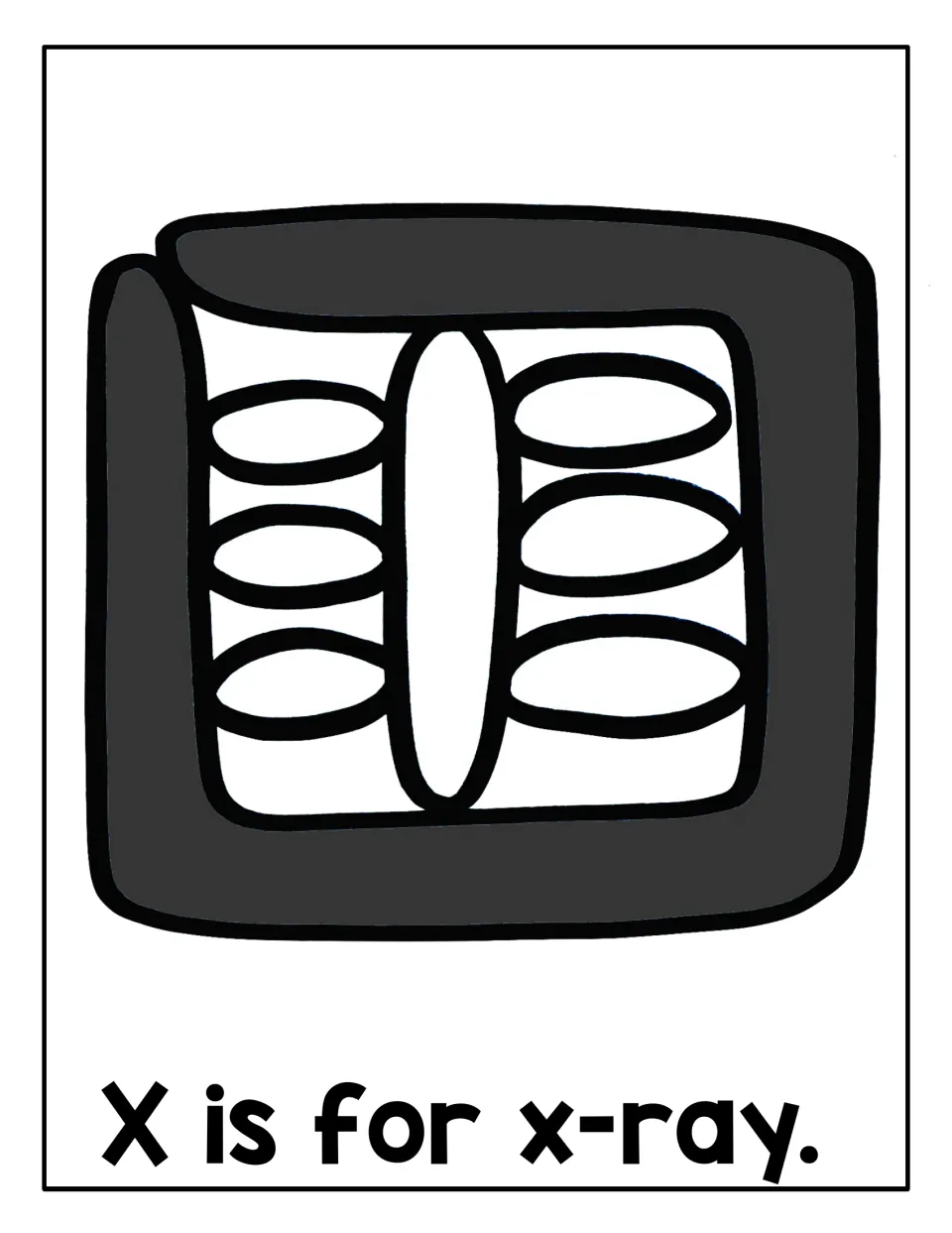 X is for x-ray: students roll playdough to fill a gray x-ray picture of a spine and ribs for letter X sound practice
