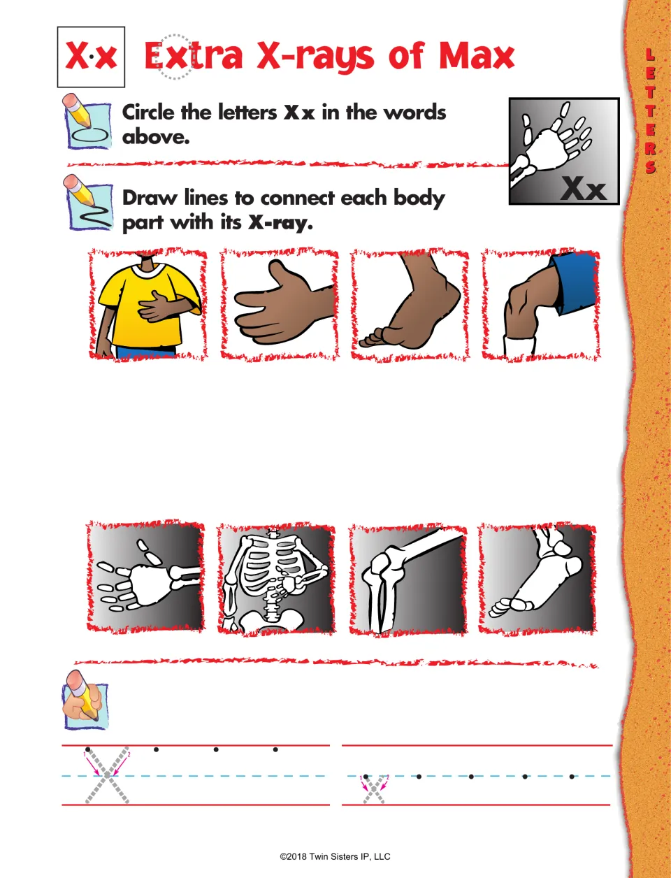 Letter X practice: find Xx in “Extra X-rays of Max,” match body parts to their X-rays, and write X and x