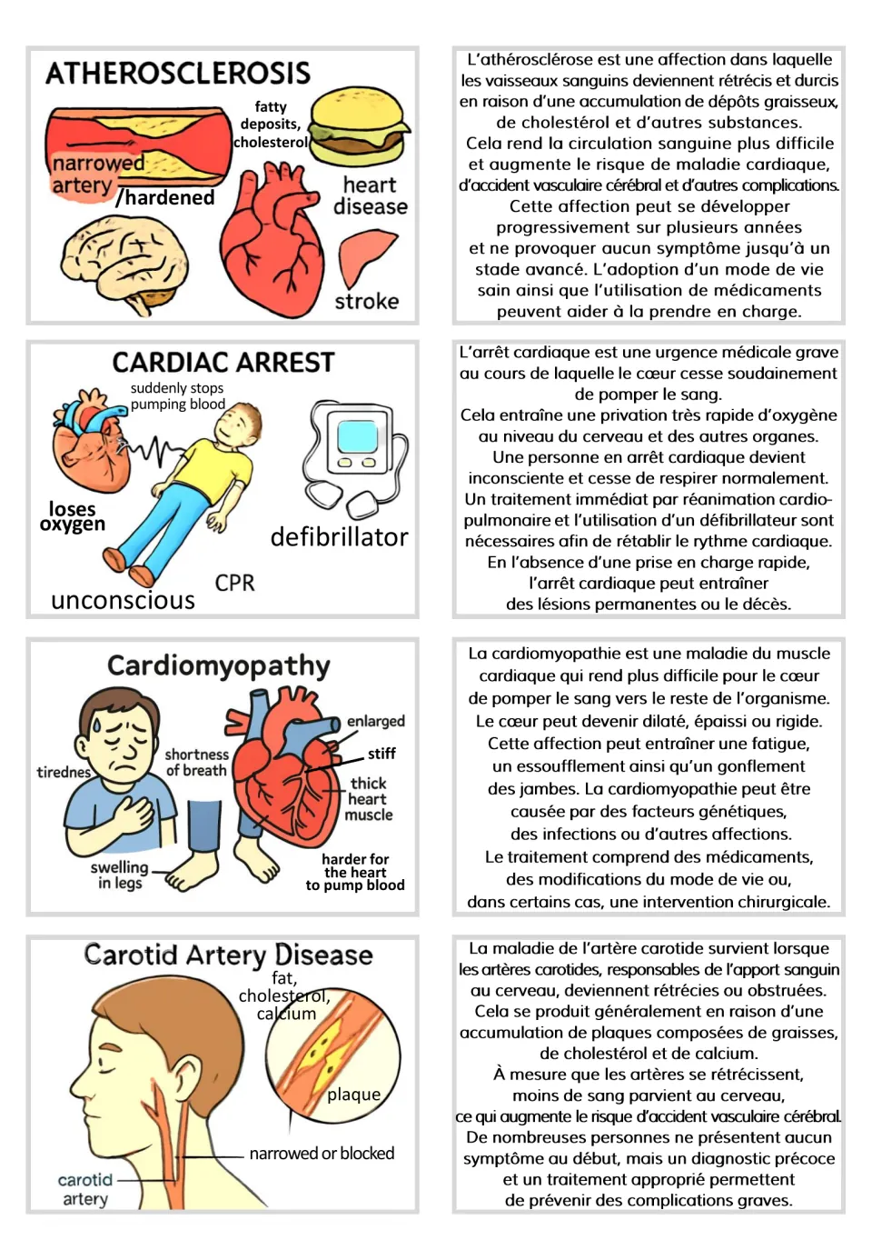 Visual and French text card pairs for atherosclerosis, cardiac arrest, cardiomyopathy, and carotid artery disease
