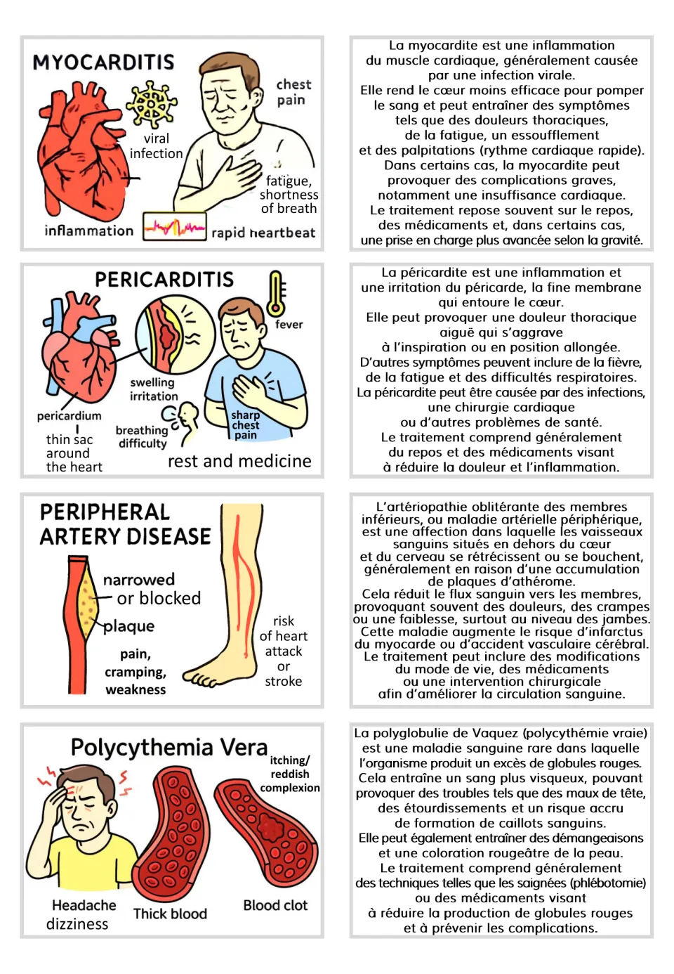 Visual and French text card pairs for myocarditis, pericarditis, peripheral artery disease, and polycythemia vera