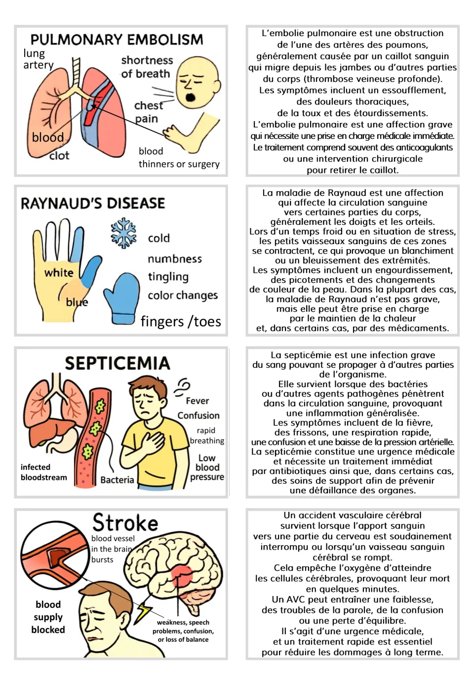 Visual and French text card pairs for pulmonary embolism, Raynaud’s disease, septicemia, and stroke