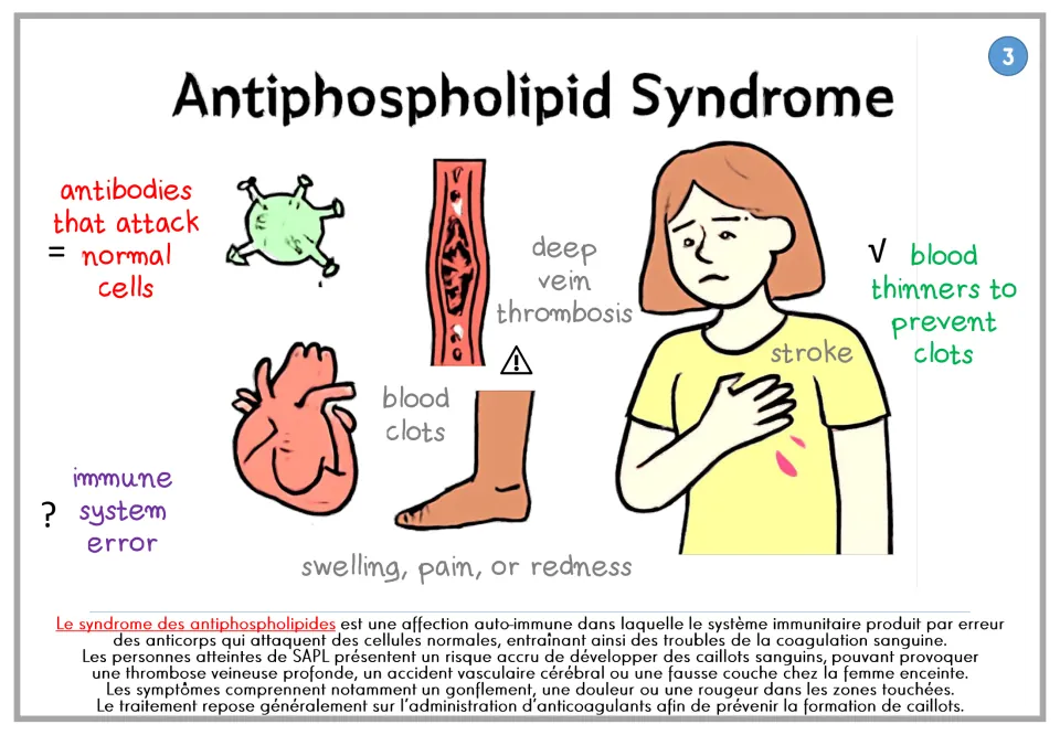 Antiphospholipid syndrome poster covering antibodies, blood clots, and blood thinners, with French text