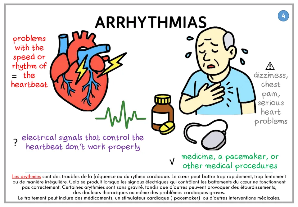 Arrhythmias poster explaining heartbeat rhythm problems, electrical signals, and treatment, with French text