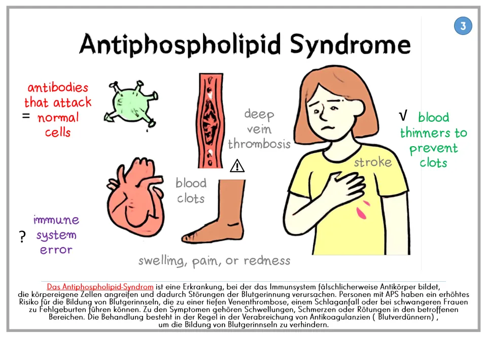 Antiphospholipid syndrome poster 3: antibodies, blood clots, symptoms, and blood thinners, plus German text