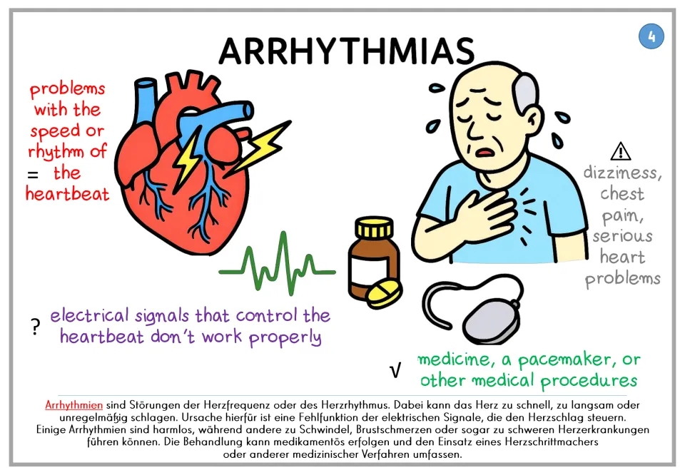 Arrhythmias poster 4: heartbeat speed or rhythm problems, electrical signals, and treatment, plus German text