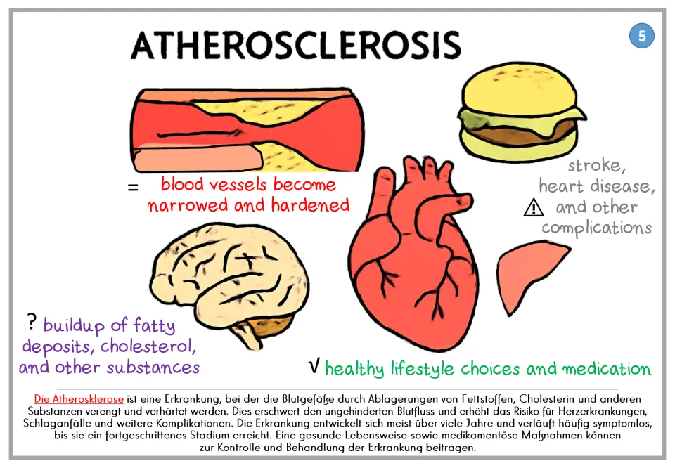 Atherosclerosis poster 5: narrowed blood vessels, fatty deposits, complications, and care, plus German text
