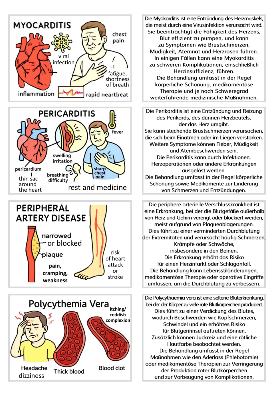 Flashcard pairs 25–28: myocarditis, pericarditis, peripheral artery disease, and polycythemia vera
