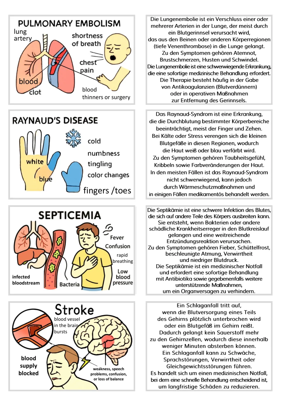 Flashcard pairs 29–32: pulmonary embolism, Raynaud’s disease, septicemia, and stroke, with German texts