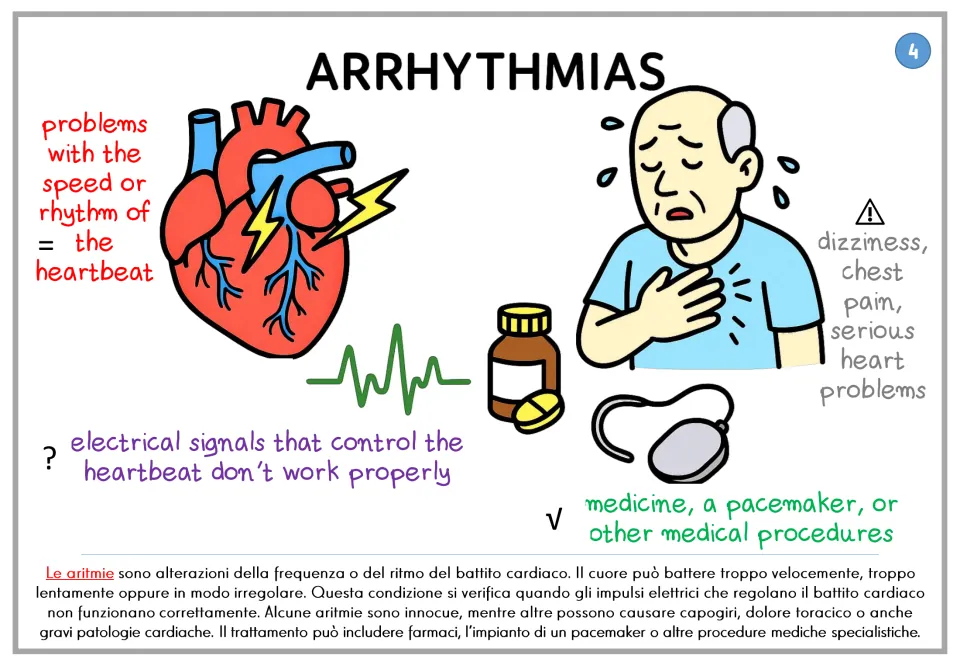 Arrhythmias poster explaining heartbeat rhythm problems, symptoms, and treatments, with Italian text