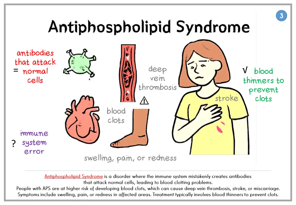 Antiphospholipid Syndrome poster: antibodies attack normal cells, causing clots, deep vein thrombosis and stroke risk