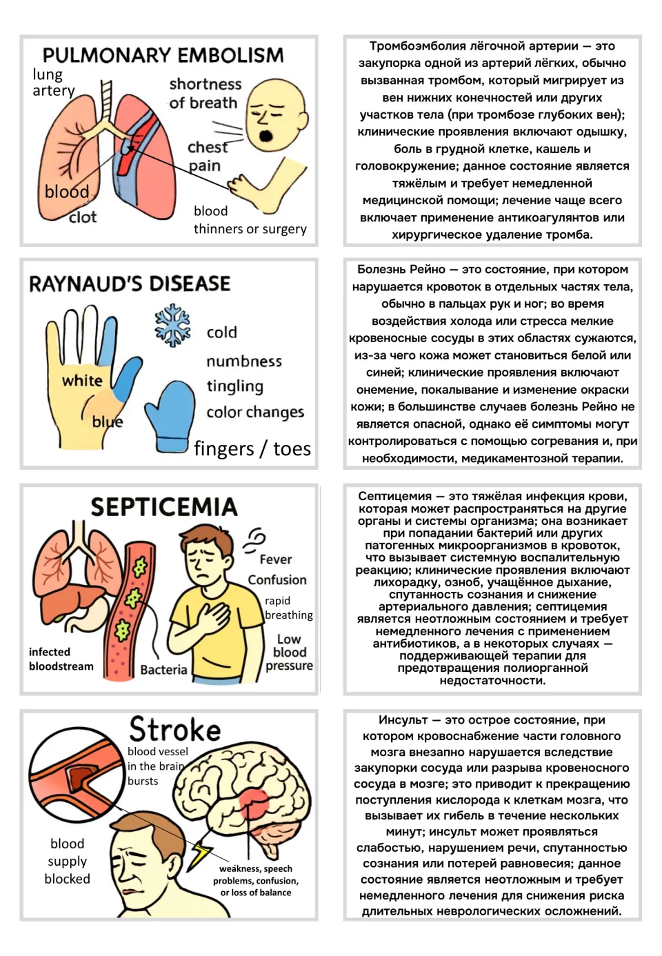 Visual flashcards and Russian text for pulmonary embolism, Raynaud's disease, septicemia, and stroke
