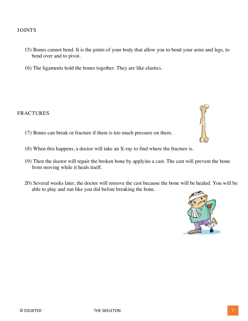 Skeleton reading part 2 presents facts 15–20 about joints, ligaments, fractures, X-rays, casts, and bone healing