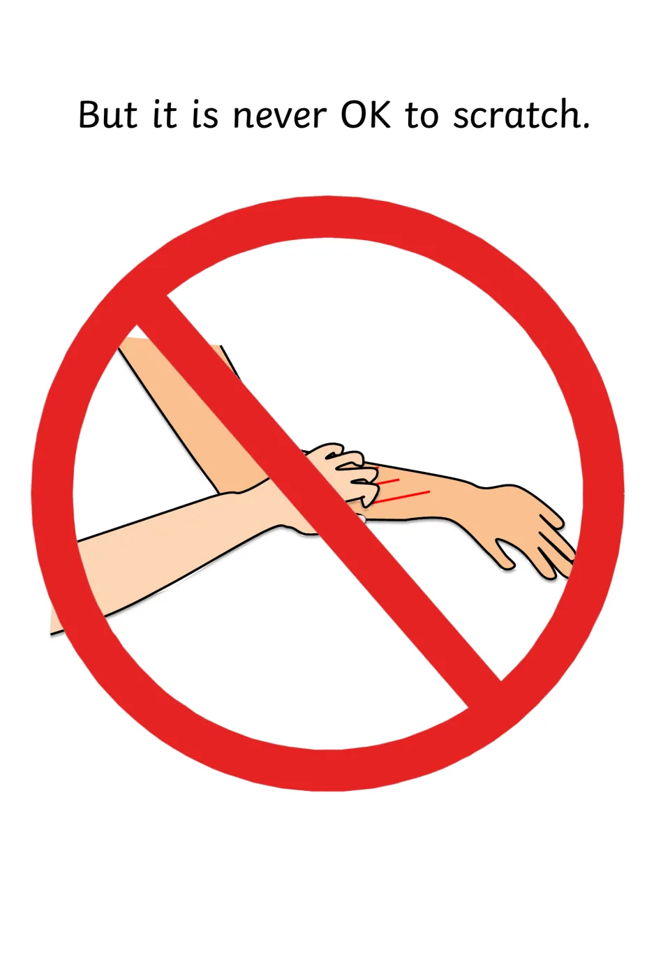 Rule page stating "But it is never OK to scratch" with a red prohibition sign over an arm being scratched
