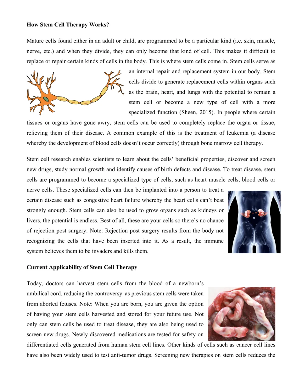 How stem cell therapy works: passage on repairing tissue, leukemia treatment, umbilical cord harvesting and drug screening