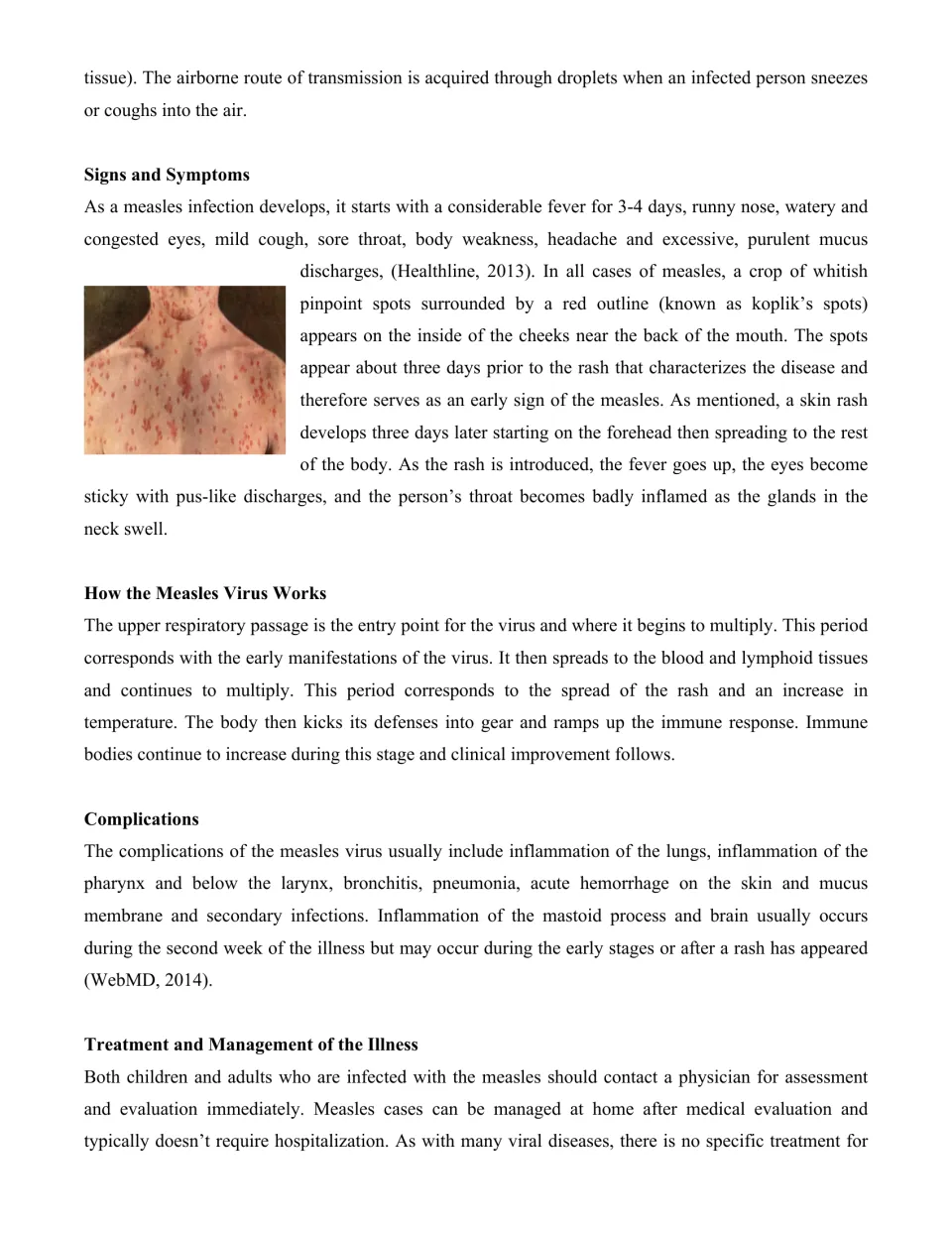 Second article page covers measles symptoms, how the virus works, complications, and treatment basics