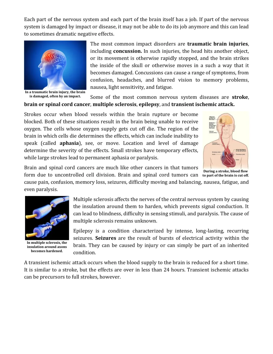 Nervous system disorders: students read about concussion, stroke, spinal cord cancer, multiple sclerosis and epilepsy