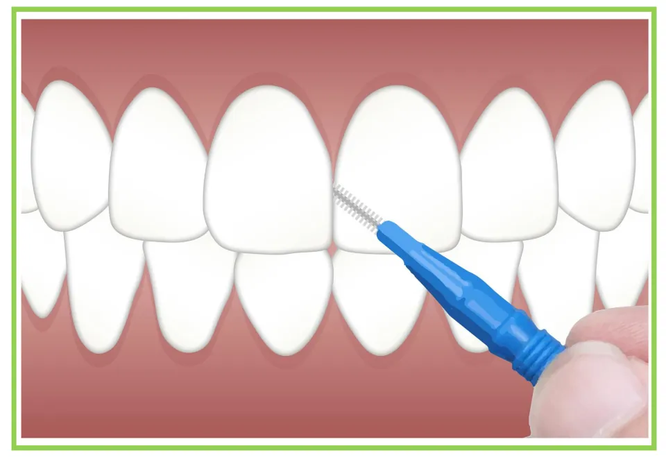 Dentist-themed writing and discussion card 5: a hand holding a small blue interdental brush between teeth
