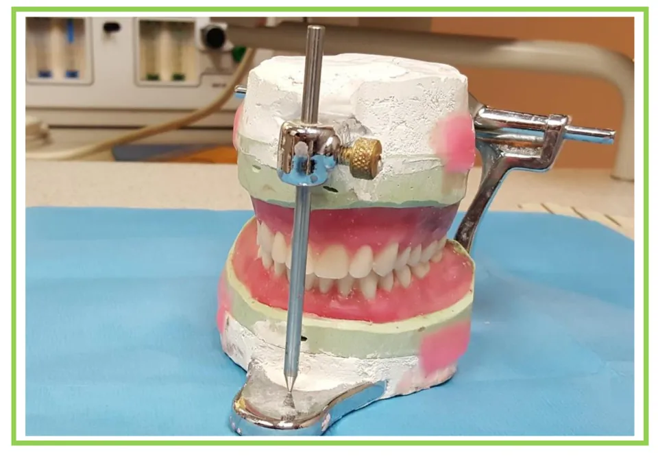 Dentist-themed writing and discussion card 8: a model of upper and lower teeth held in a metal apparatus