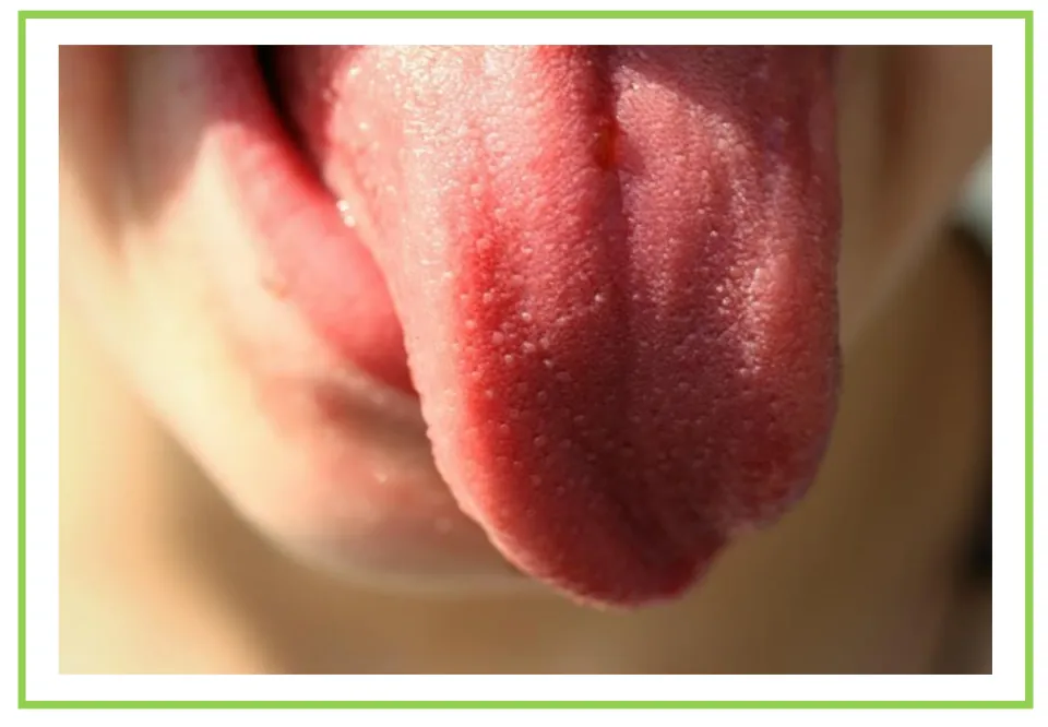 Meals and diet discussion flashcard 2: a close-up of an extended tongue as a photographic writing prompt