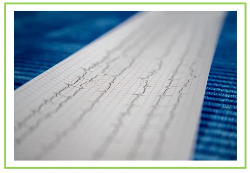 Medical center writing and discussion flashcard 8 shows an electrocardiogram printout of heart activity.